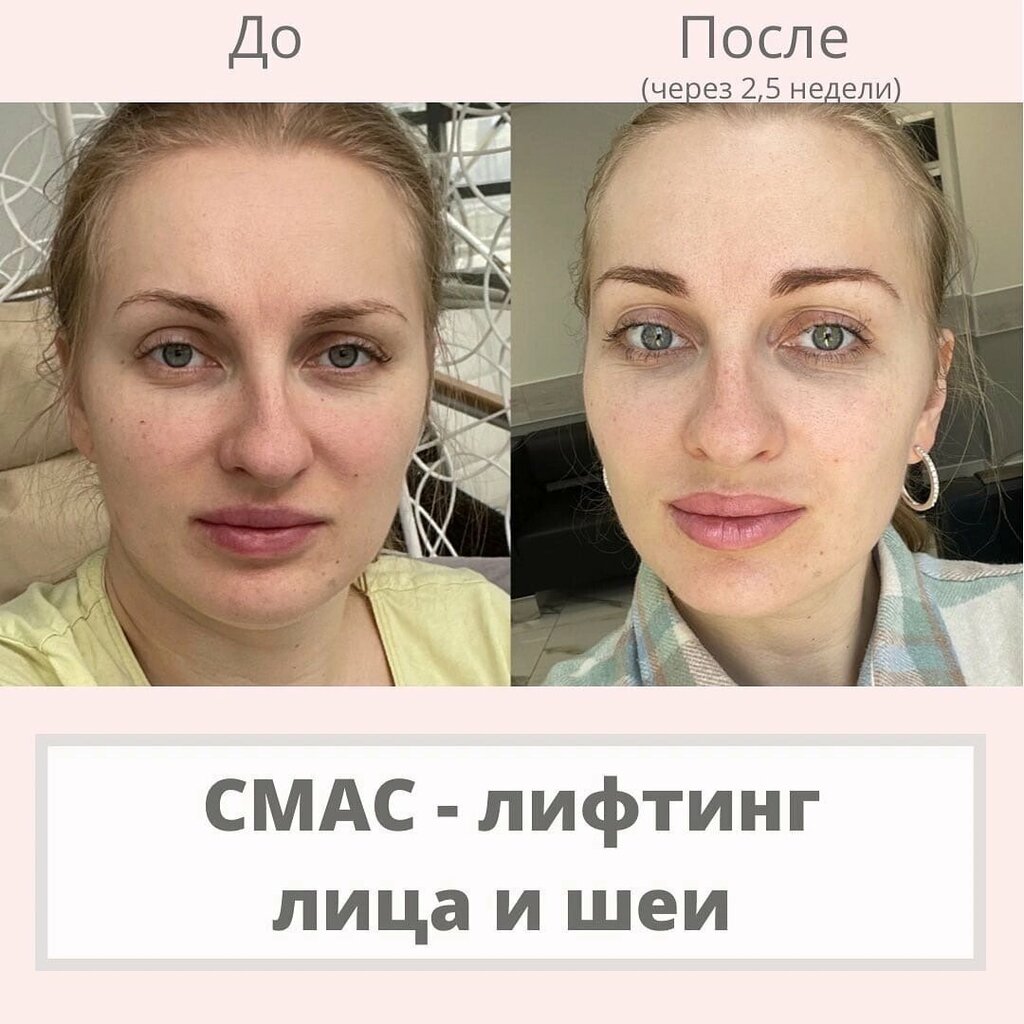 علم التجميل Cosmetology clinic ، سان بطرسبرغ، صورة