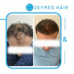 Zeymed Hair Clinic (Istanbul, Sisli, Mesrutiyet Neighborhood, Haci Mansur Street, 14) ، مركز طبي، عيادة