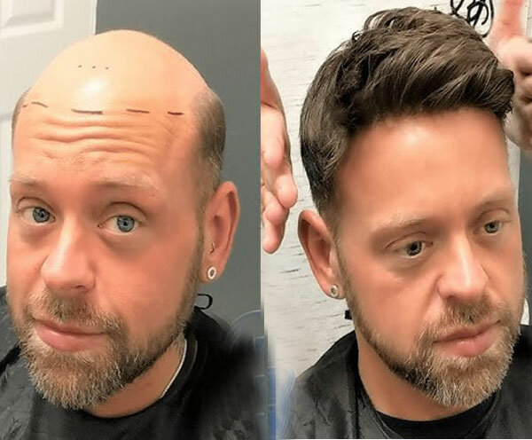 Hair removal Smart Hair Fixing, Earth, photo