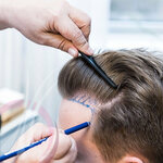 Sdy Hair Problems Center (Konya, Selçuklu, İhsaniye Mah., Erguven Sok., 4) ، صالون تجميل