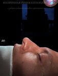 Rauf Yusifzade Plastic surgery clinic (Komsomolskiy Avenue, 32к2) ، جراحة تجميلية