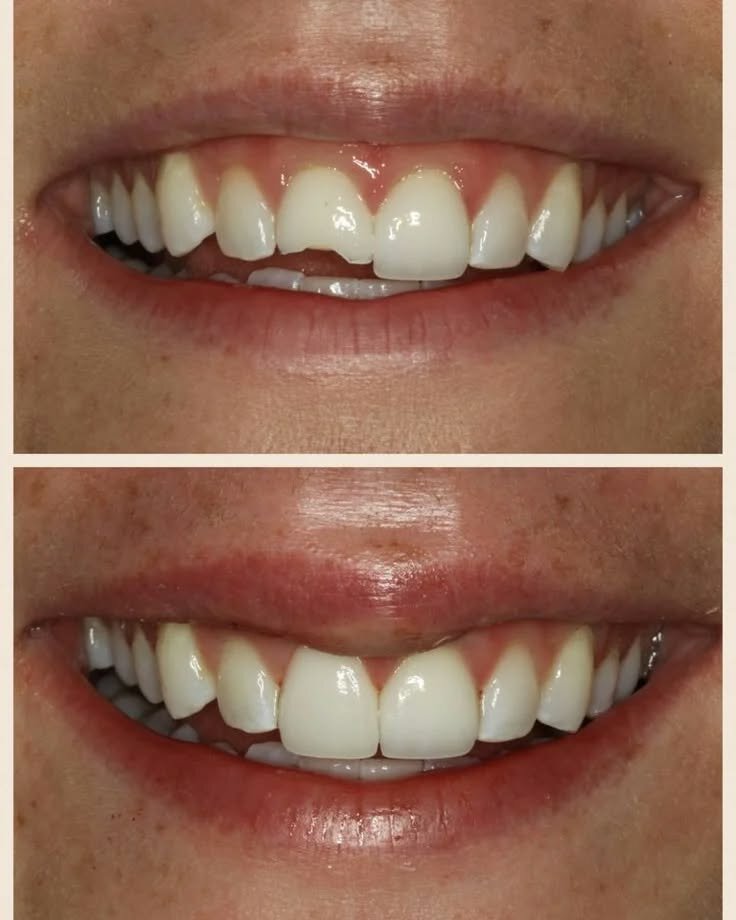 عيادات الأسنان Bolukbasi Dental Clinic ، ، صورة