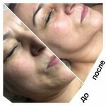 Ручная пластика лица (Lesnaya ulitsa, 1) ، علم التجميل