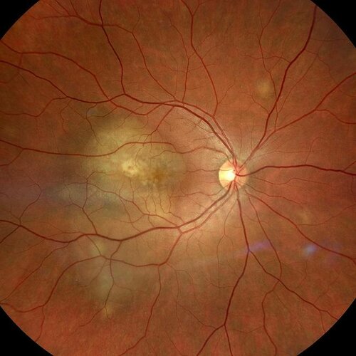 İstanbul Retina Enstitüsü, göz sağlığı merkezleri, İstanbul, Beşiktaş ...