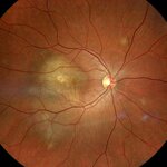 İstanbul Retina (İstanbul, Besiktas, Hakkı Yeten Cad., 19), corrección de la vista
