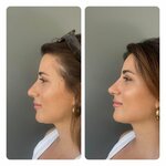 Mert Secer Clinic (İstanbul, Kadikoy, Bagdat Avenue, 499B), plastic surgery
