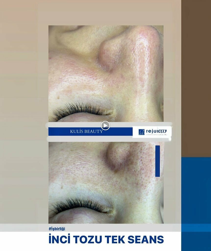 Beauty salon Kulis Beauty & Make-up Studio Kumluca Laser Hair Makeup Beauty, Kumluca, photo