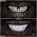 Premium Dental Turkey (Antalya, Muratpasa District, Guzeloba Neighborhood, Caglayangil Avenue, 7A), dental clinic