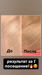 Shelkovya (Mashtakova Street, 12), hair removal