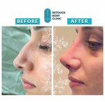 Retouch Body Clinic (Istanbul, Sisli, Sehit Ahmet Street, 6-10), plastic surgery