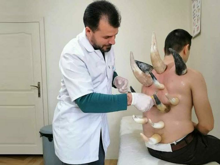 Private practice doctors Alternatif Hacamat Olarak, Konya, photo