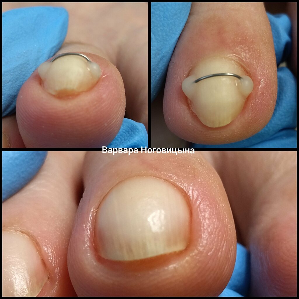 علم دراسة التربة Podologist Nogovitsyna V. ، ، صورة