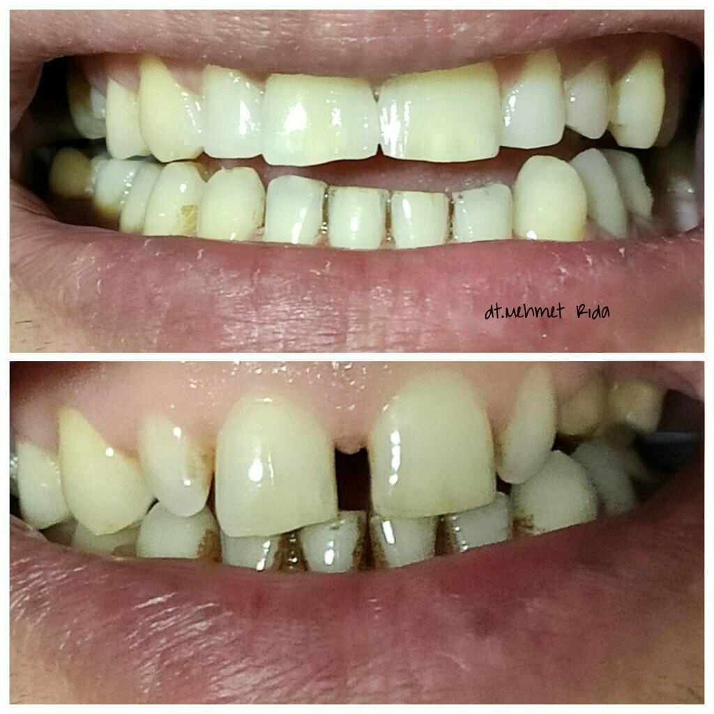 Private practice doctors Dentist Mehmet Rida Aksoy-Midyat, Midyat, photo