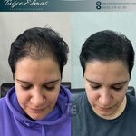 Hair Simulation Izmir (Izmir, Mehmet Akif Avenue, 7D), plastic surgery