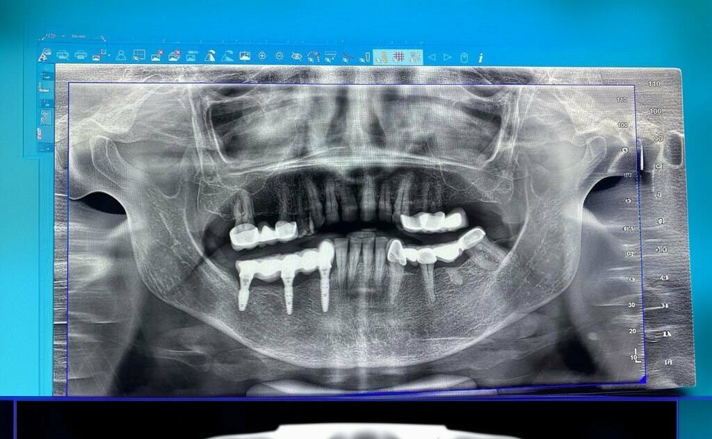 Private practice doctors Dentist Mehmet Rida Aksoy-Midyat, Midyat, photo