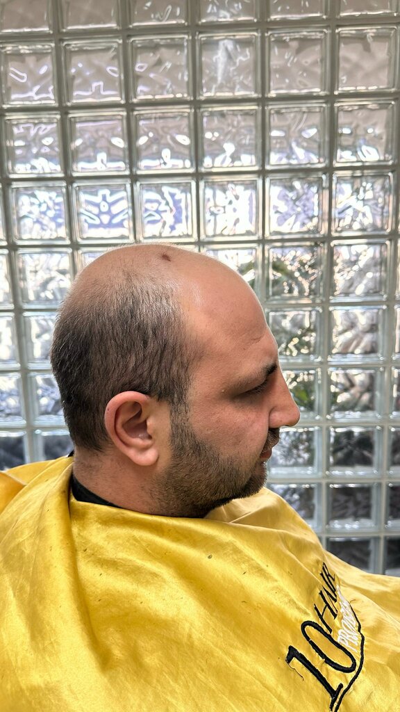 Barber shop Protez Saç İzmir Berat Arkan, Izmir, photo
