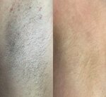 Электро Юма (Rozhdestvenskaya Street, 20А), hair removal