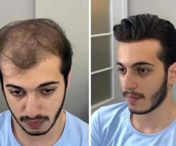 Hair removal Smart Hair Fixing, Earth, photo