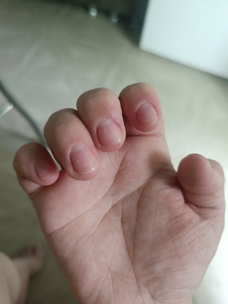 Podology Ногтевая помощь, Astrahan, photo