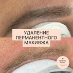 Malena Lazer (Semenyuka Street, 11), hair removal