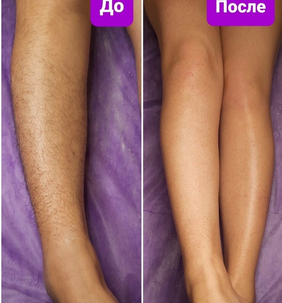 Sugaring Шугаринг, Bryansk, photo