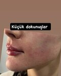 Dr. Belda Yurtseven Tuner - Eskisehir Botox, Eskisehir Lip Filler, Eskisehir Nose Filler (Eskişehir, Tepebasi District, Ismet Inonu-1 Boulevard, 65B), médicos privados
