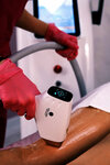 Laser Lab салон лазерной эпиляции Минусинск (ulitsa Gagarina, 13), hair removal