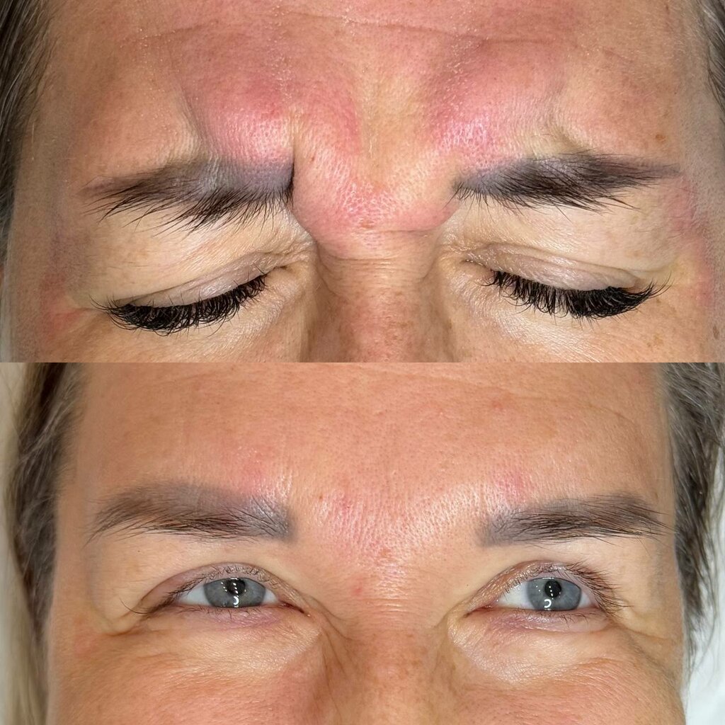 Cosmetology Divi-laser, Lubercy, photo