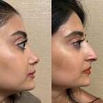 Dr. Fatih Sadikoglu Rhinoplasty Istanbul Ent Clinic Head and Neck Surgery (İstanbul, Besiktas, Hakkı Yeten Cad., 11A), public fund