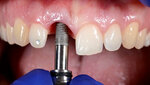 Стоматология Байрамова Эмиля (Leningradskoye Highway, 21), dental clinic