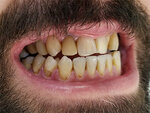 U Smile Turkey (Antalya, Muratpasa District, Savas Avenue, 34), dental clinic