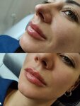 Lip Is Not A Fool (Admirala Rudneva Street, 4) ، علم التجميل