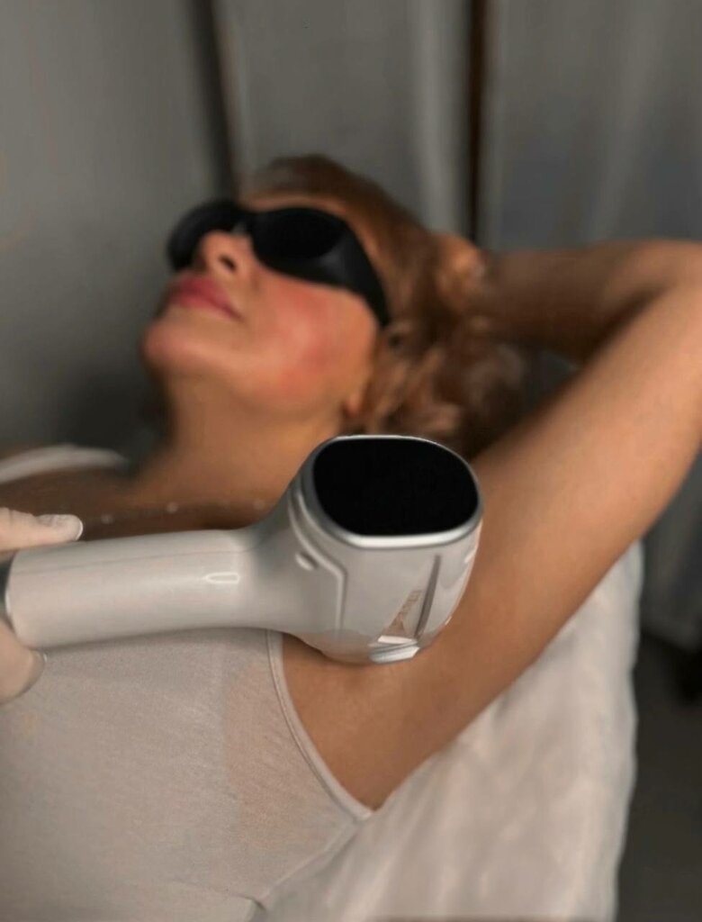 Hair removal Krasivoe Mesto, Ivanteevka, photo