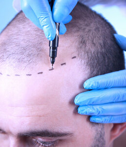 Cap Hair Clinic (Muş, Muş Merkez , Sunay Mah., 205. Sok., 21), beauty salon