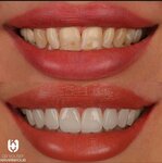 Zubkoff (Kenesary kóshesi, 43), clínica dental