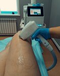 Студия лазерной эпиляции (posyolok gorodskogo tipa Verkhovye, ulitsa 7 Noyabrya, 16), hair removal