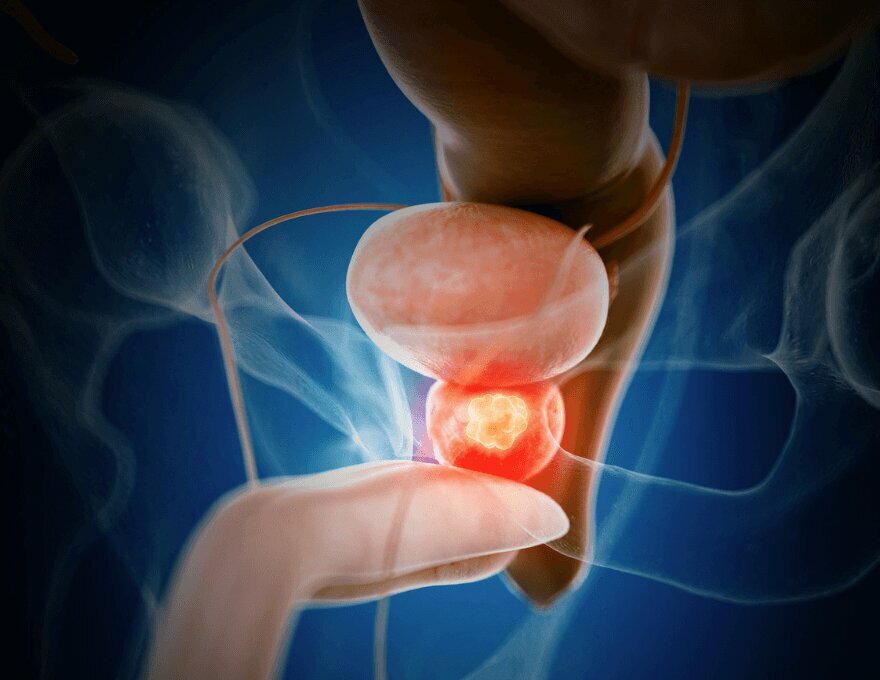 Medical center, clinic Urology Specialist Assoc. Prof. Dr. Hasan Turgut, Ortahisar, photo