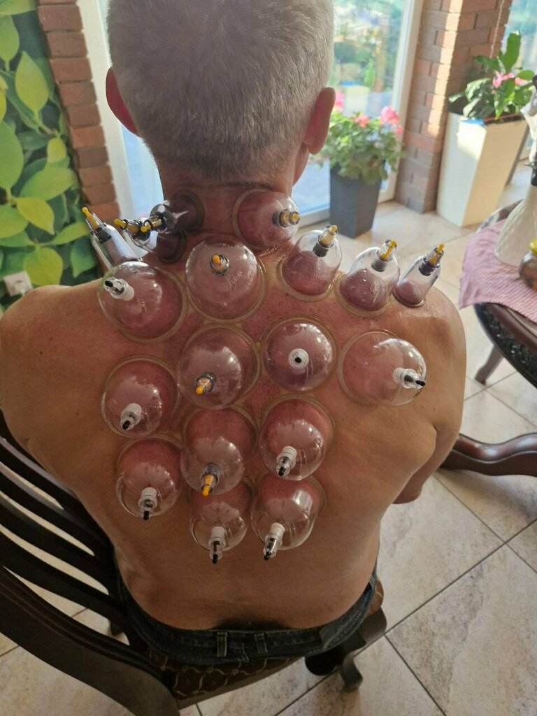 Alternative medicine Girudo Hidjama, Maykop, photo