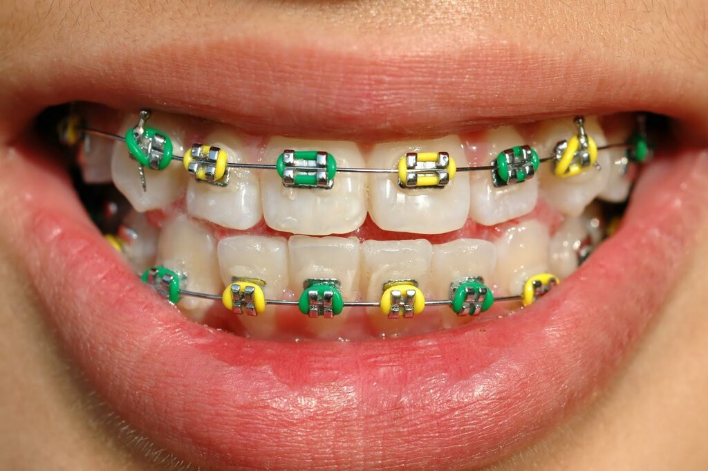 Dental clinic Dp-smile, Ankara, photo