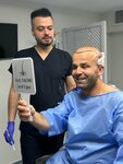 Fue Hair Transplant - Docshair Arif Ugur (Gaziantep, Sehitkamil District, Hafiz Tevfik Street, 162), plastic surgery