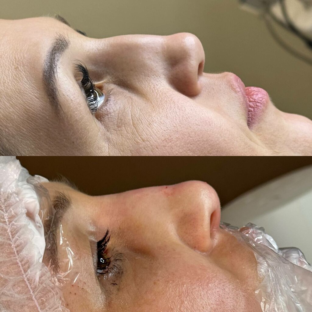 Cosmetology Divi-laser, Lubercy, photo