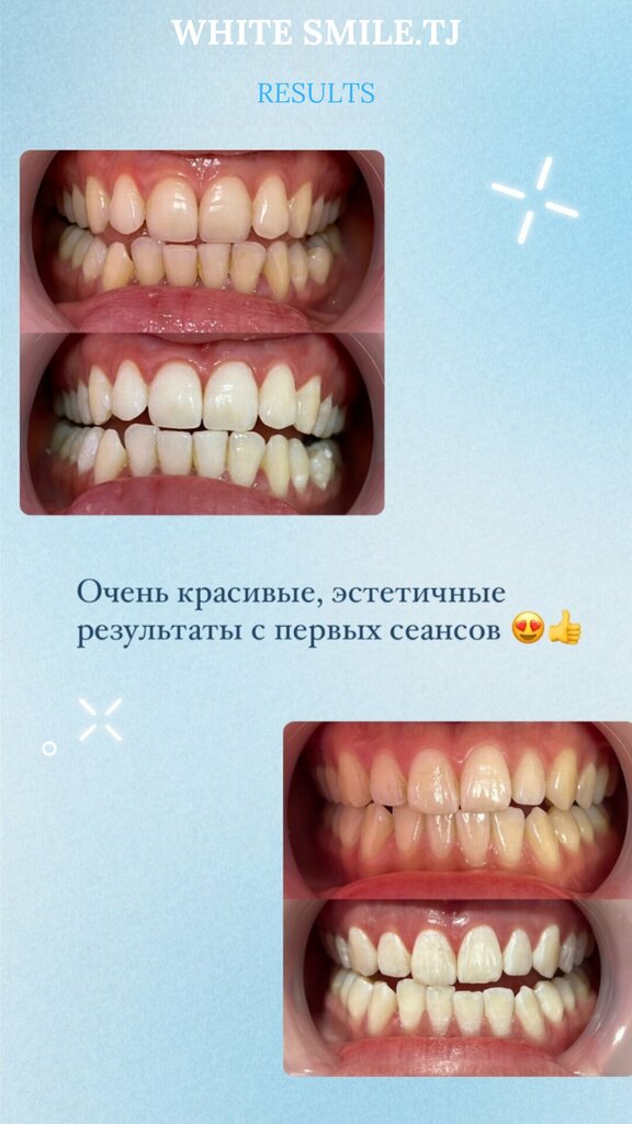 Стоматологическая клиника White Smile, Душанбе, фото