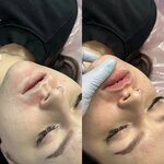Pro COSMOs (Narodnogo Opolcheniya Avenue, 6), cosmetology