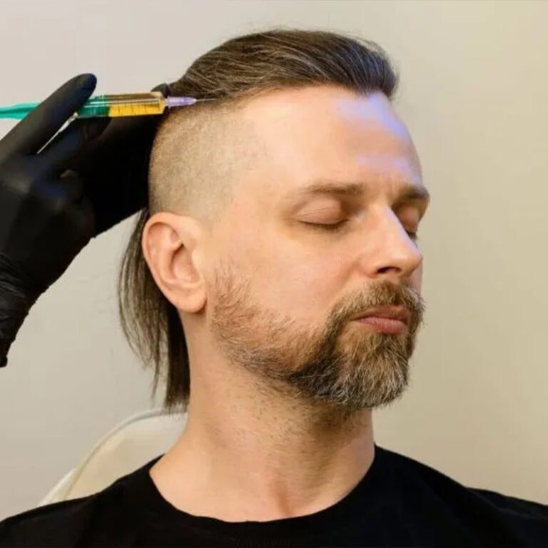 Hair Legends Hair Transplant Antalya