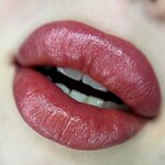 Avi Clinic (Krasnodarskaya ulitsa, 10А), cosmetology