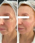 Savoir clinic (Tsvetnoy Boulevard, 26с1), cosmetology