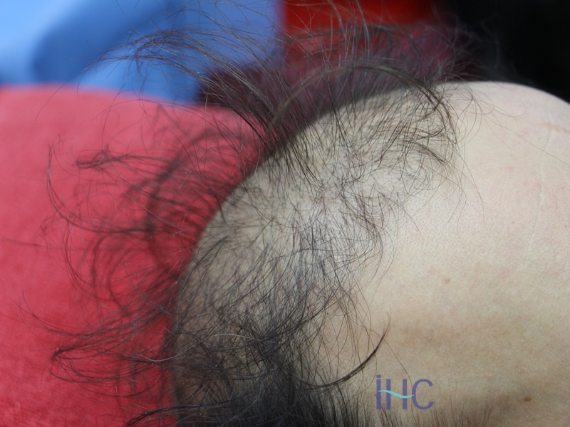 Istanbul Hair Center