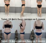 Uakim Beauty Body (Dmitrovskoye Highway, 107Ак5), hair removal