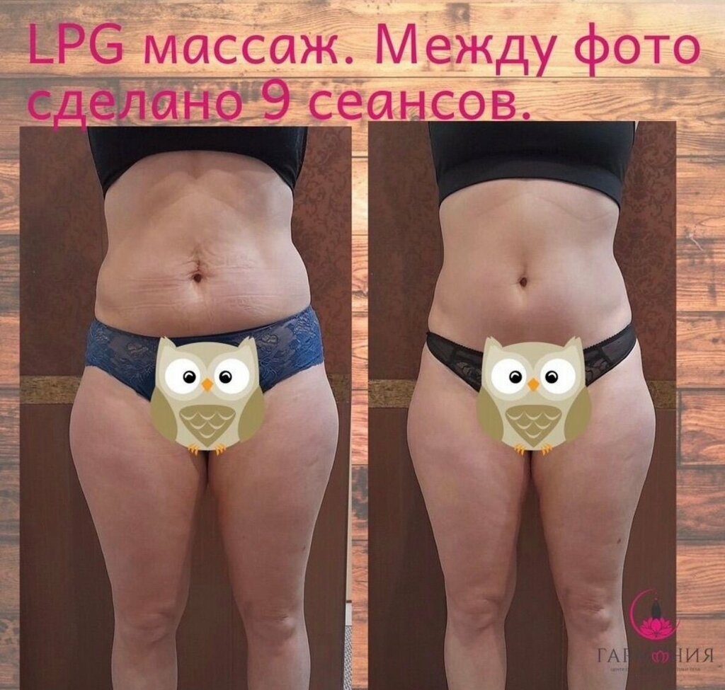 Massage salon Lpg массаж, Ozery, photo