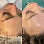 Elya_cosmetolog_almaty (Saken Seifullin Avenue, 174/2), cosmetology